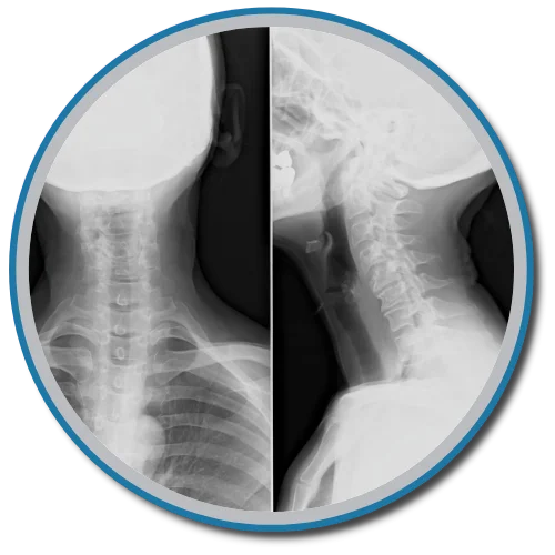 Gonstead X-rays Elkhorn NE